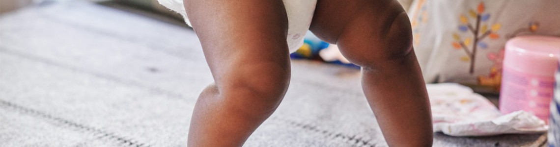 Overcoming The Monster Diaper Rash