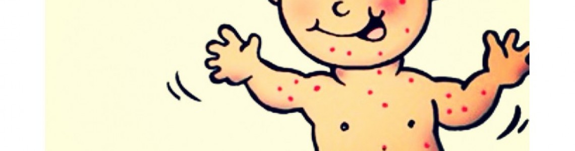 ChickenPox: Being The Parent