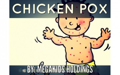 ChickenPox: Being The Parent